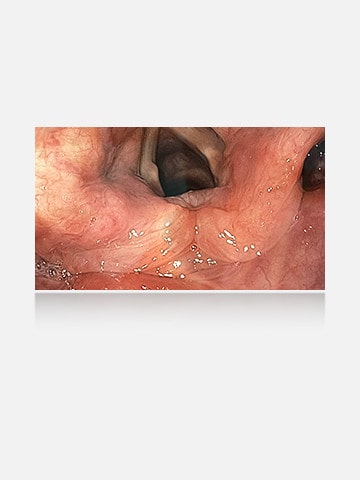 The right image, with anti-glare coating, provides a clear and unobstructed view, demonstrating the effectiveness of the coating.	