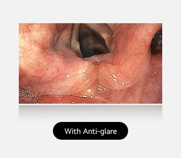 The right image, with anti-glare coating, provides a clear and unobstructed view, demonstrating the effectiveness of the coating