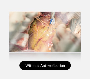 The left image shows a display without anti-reflection, with more glare and reflections affecting visibility. 	