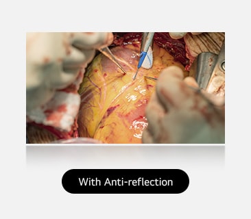 The right image, with anti-reflection coating, offers a clearer view with reduced glare.