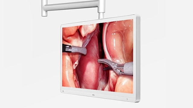 The image shows a 9.2kg lightweight medical display mounted on a ceiling, displaying a surgical procedure.