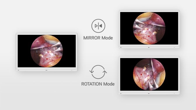 The video explains the mirror and rotation modes, allowing users to flip or rotate the display for optimal viewing during surgery.	