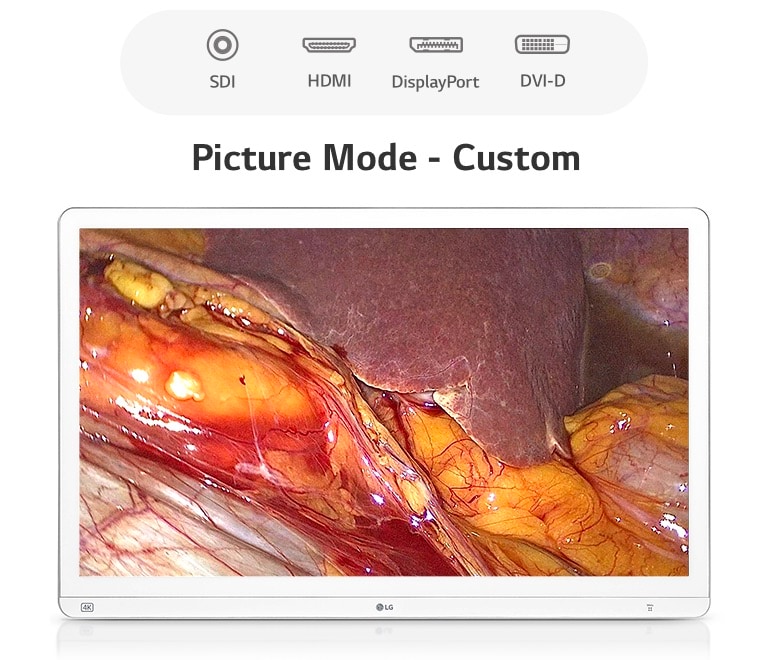 The video shows a medical monitor adjusting picture modes to match different input sources such as SDI, HDMI, DisplayPort, and DVI-D, enhancing clarity for various types of surgical video.