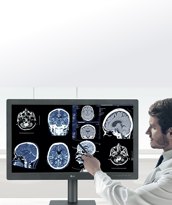 Doctor analyzing brain MRI scans on a high-resolution LG diagnostic monitor for precise medical imaging.