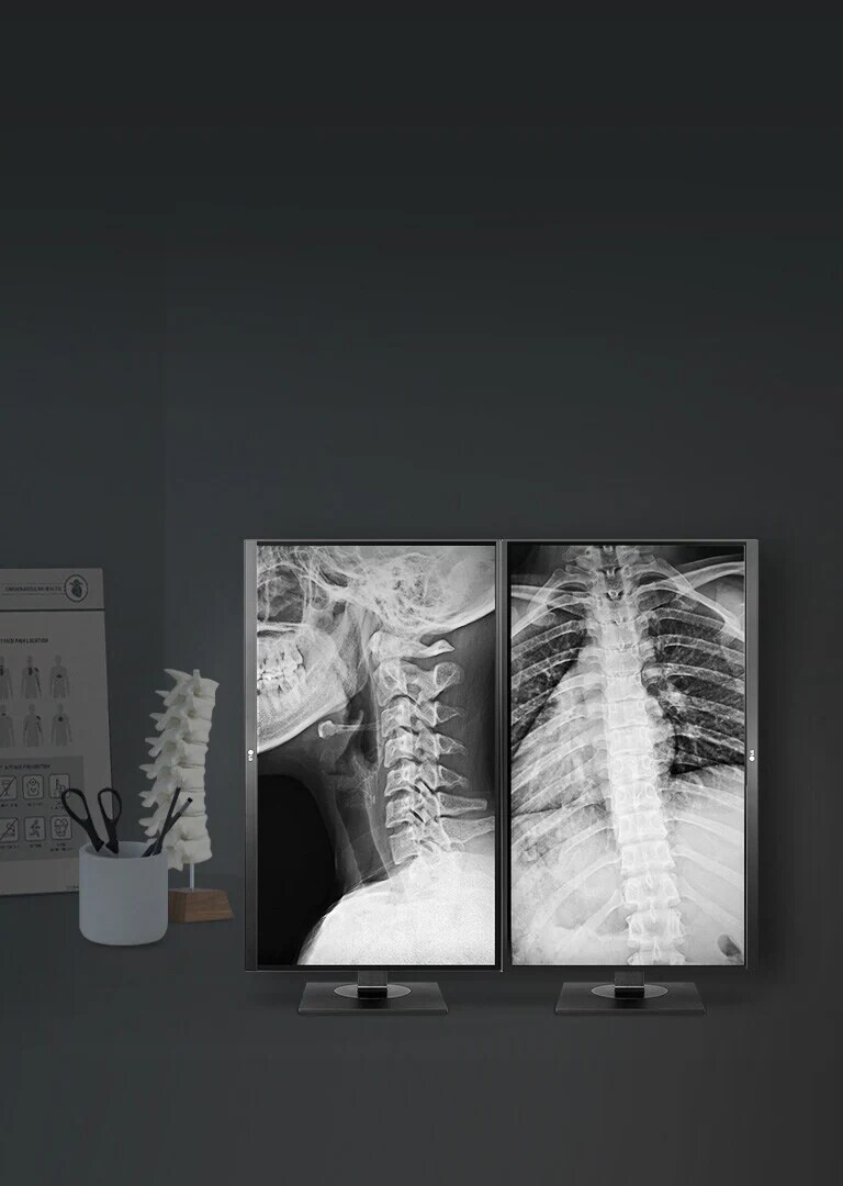 Monitor Uji Klinis yang menghasilkan gambar yang direproduksi secara akurat, sehingga memungkinkan tinjauan klinis yang tepat