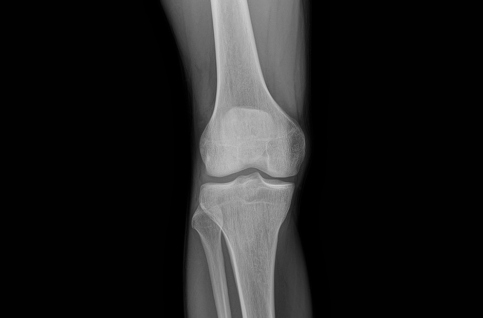 LG 17HQ701-G x-ray image 5.