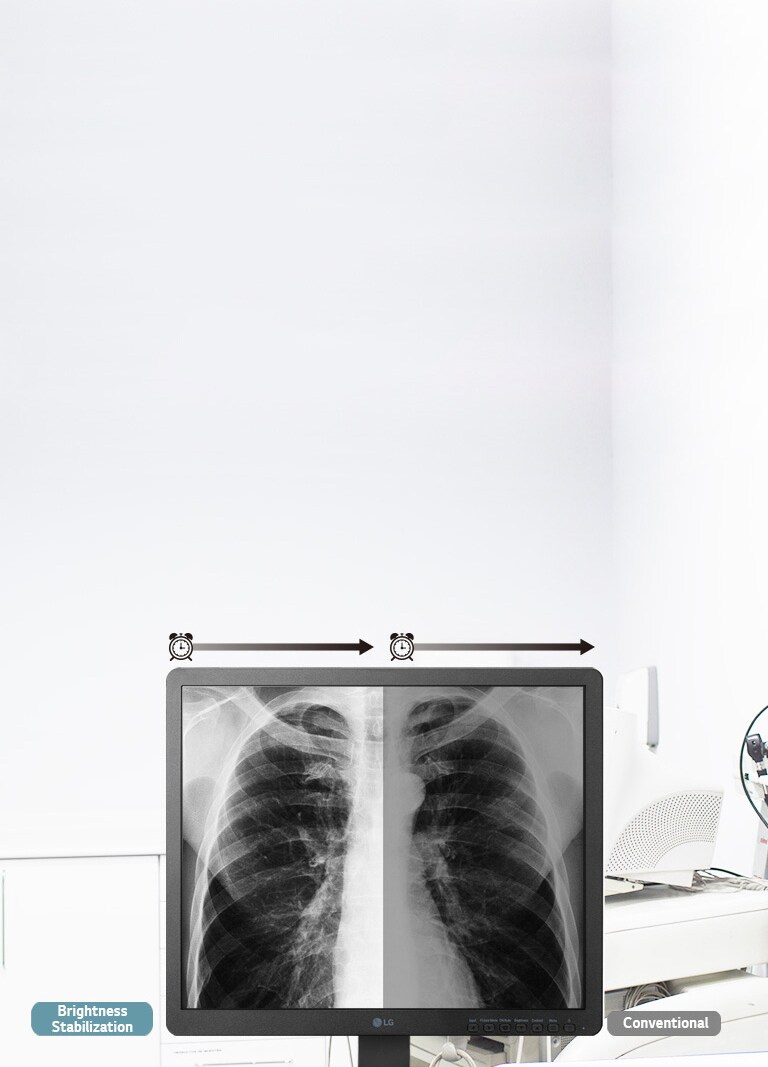 Brightness Stabilization1