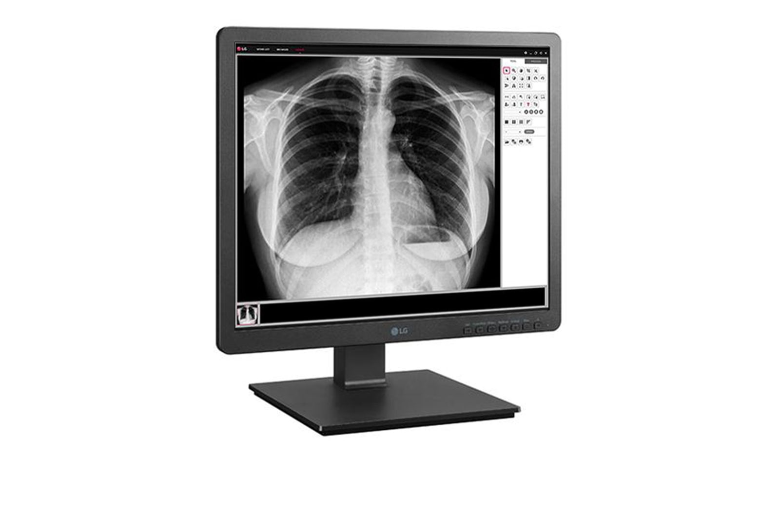 LG 19 (48.26cm) 1.3 MP Clinical Review Monitor 1280 x 1024, 19HK312C-B