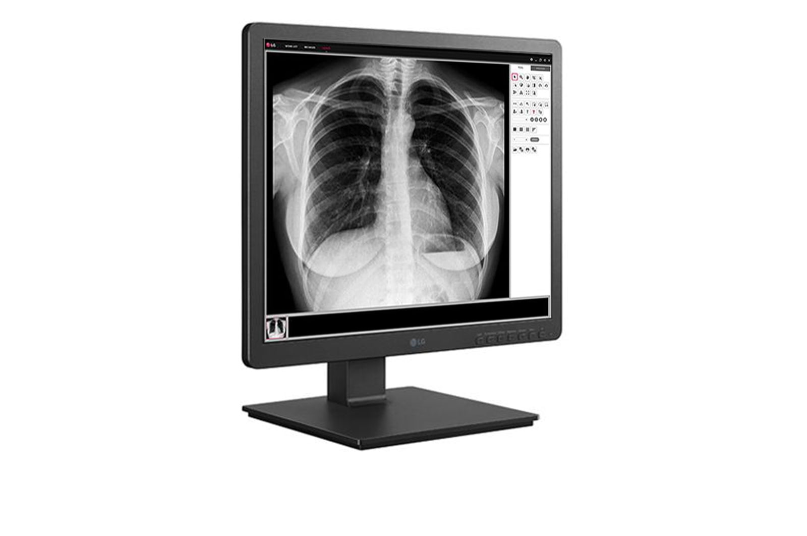 LG 19 (48.26cm) 1.3 MP Clinical Review Monitor 1280 x 1024, 19HK312C-B