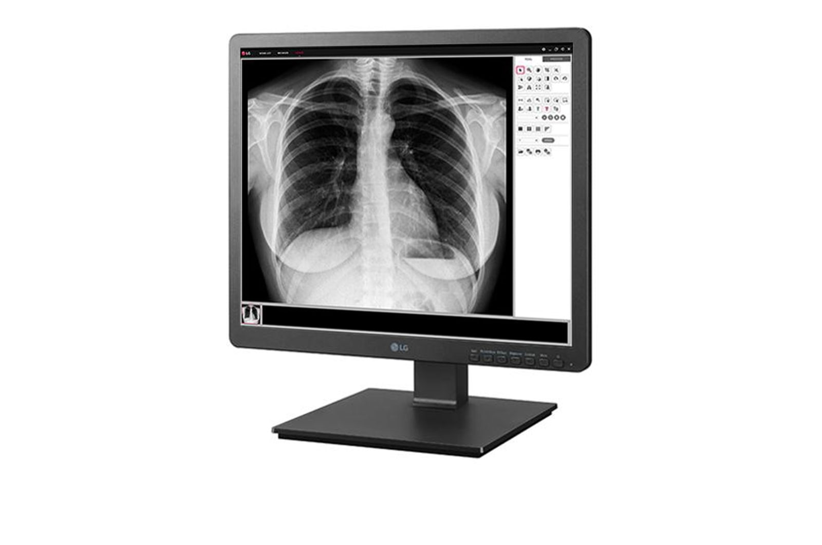 LG 19 (48.26cm) 1.3 MP Clinical Review Monitor 1280 x 1024, 19HK312C-B