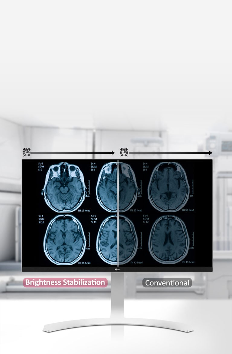 Brightness Stabilization
