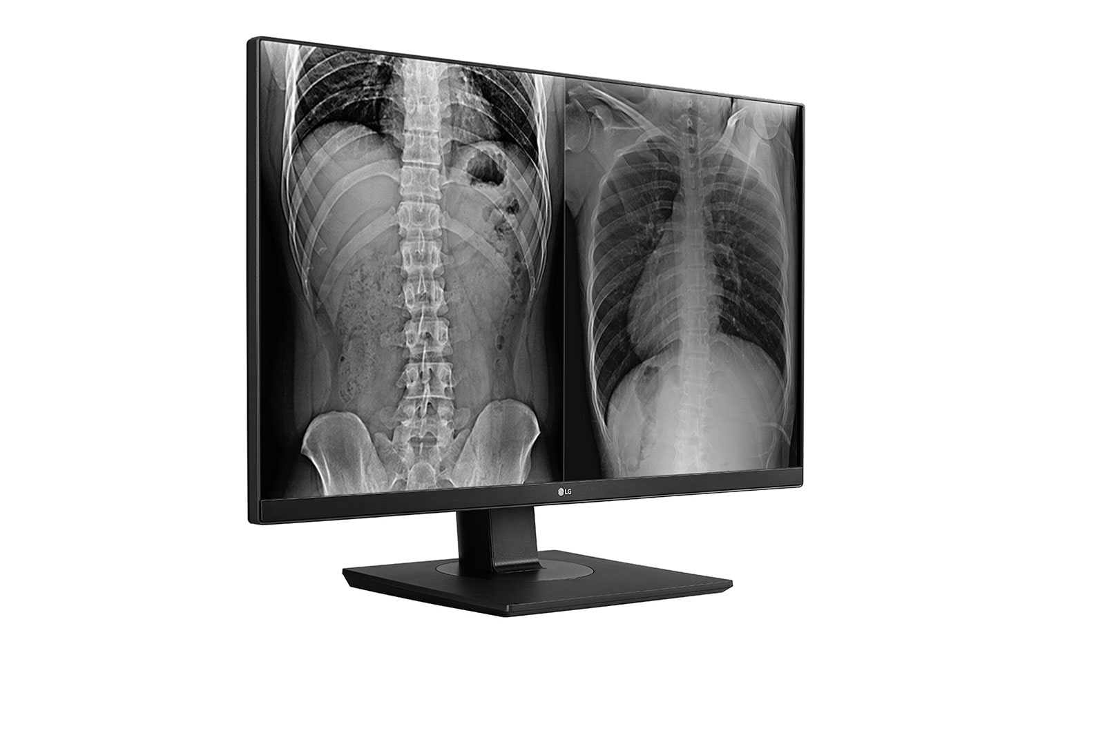 LG 8MP Clinical Review Monitor, 27HJ713C-B