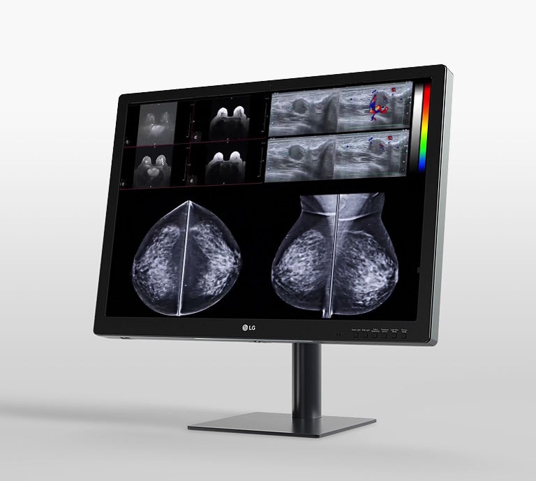 lg 31 inch 12mp ips display designed for breast imaging offering streamlined workflow, and improved comfort