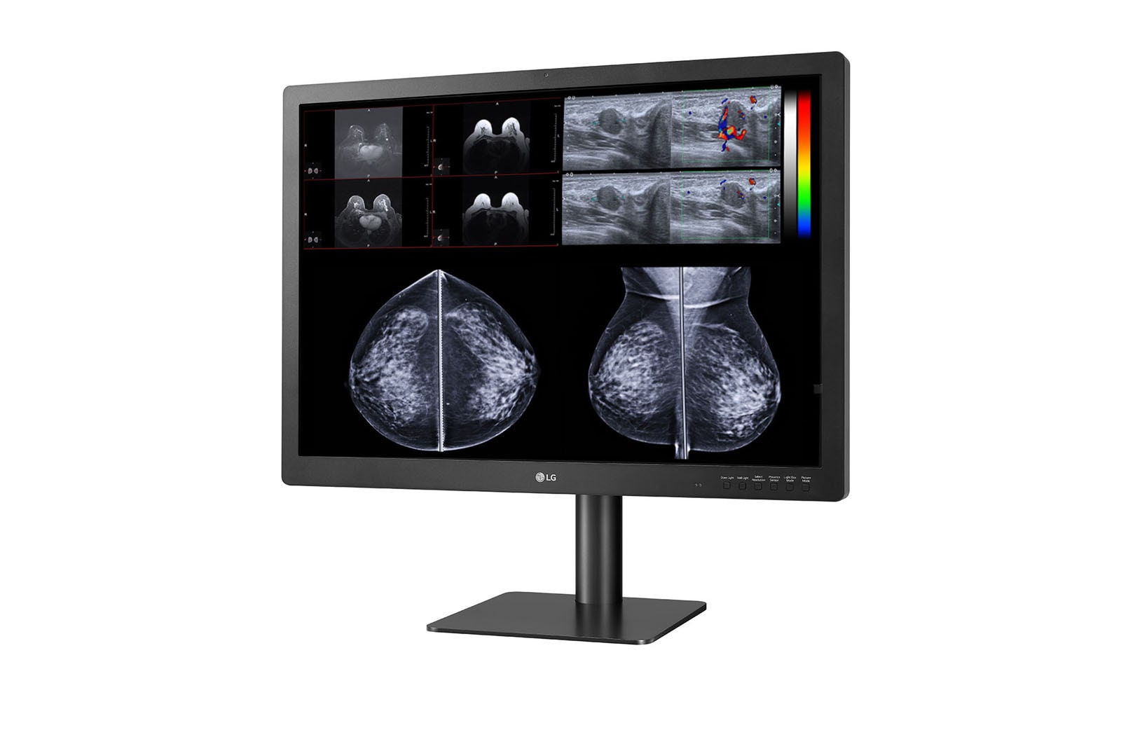 LG 31 (78.74cm) 12MP Diagnostic Monitor for Mammography, 31HN713D-B