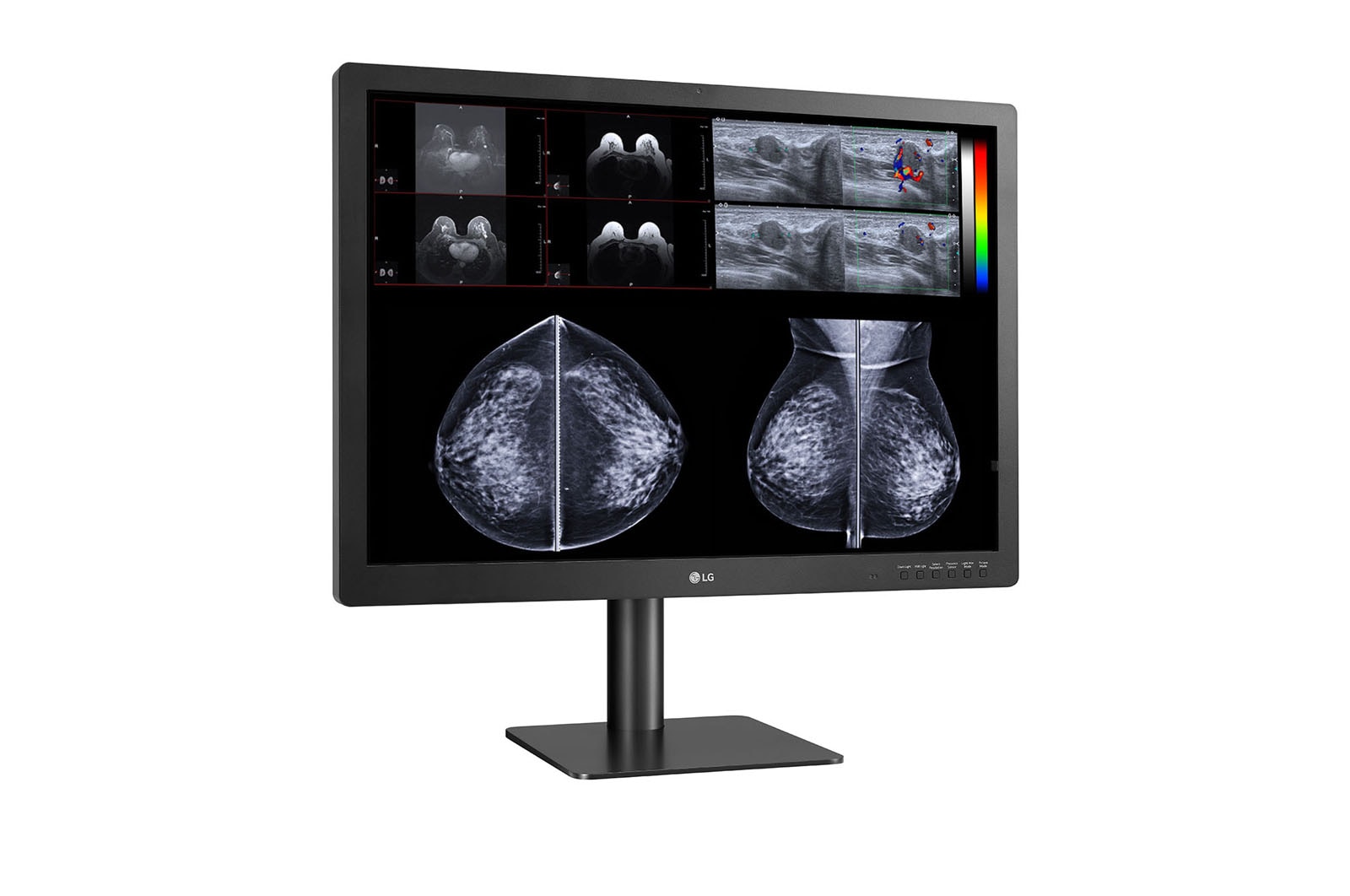 LG 31 (78.74cm) 12MP Diagnostic Monitor for Mammography, 31HN713D-B