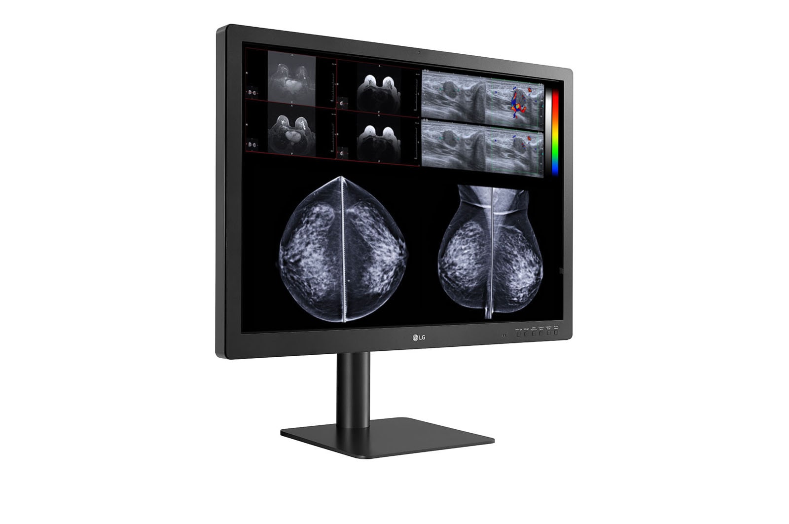 LG 31 (78.74cm) 12MP Diagnostic Monitor for Mammography, 31HN713D-B