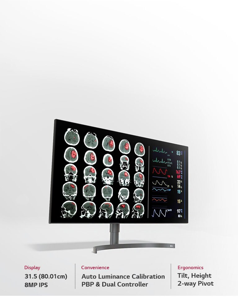 31.5 (80.01cm) 8MP Diagnostic Monitor