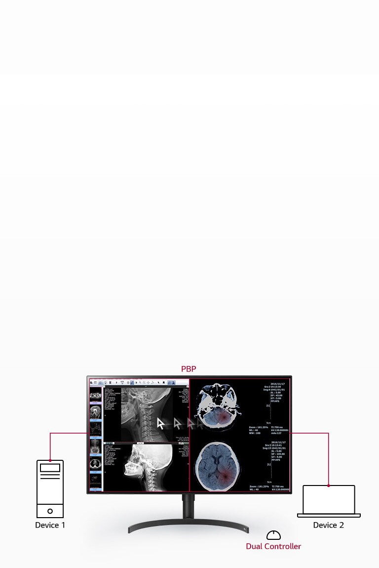 Multiple Signals on One Screen
