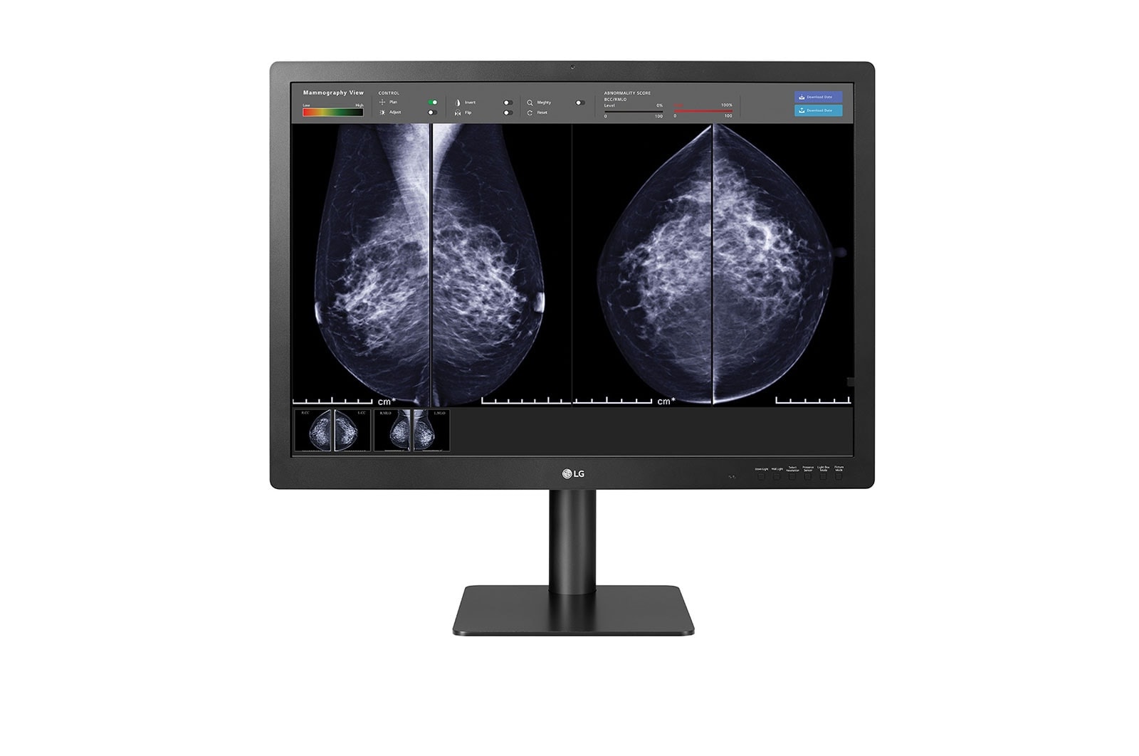 LG 31'' 12MP IPS Diagnostic Monitor for Mammography, 31HN713D