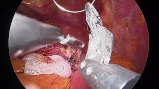 LG Monitor Quirúrgico 31.5" 4K IPS, 32HL710S