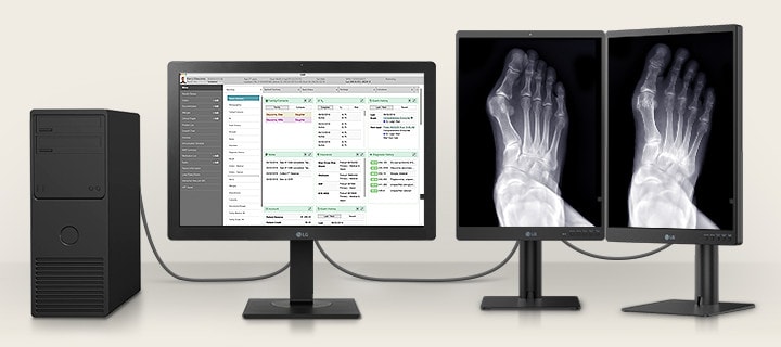 Puede conectar un 24HR513C con dos monitores de diagnóstico de 3 MP, mostrando historias clínicas de pacientes en un 24HR513C e imágenes médicas en dos monitores de 3 MP.