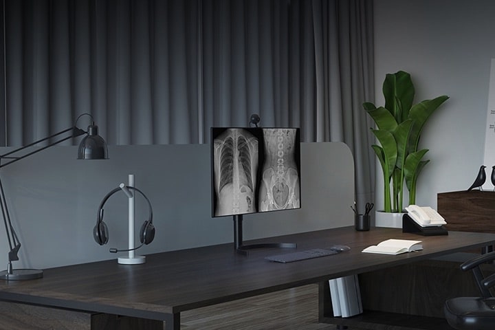 Un entorno de oficina con monitores de imágenes médicas que muestran radiografías y representan las pantallas médicas de LG para profesionales de la salud.