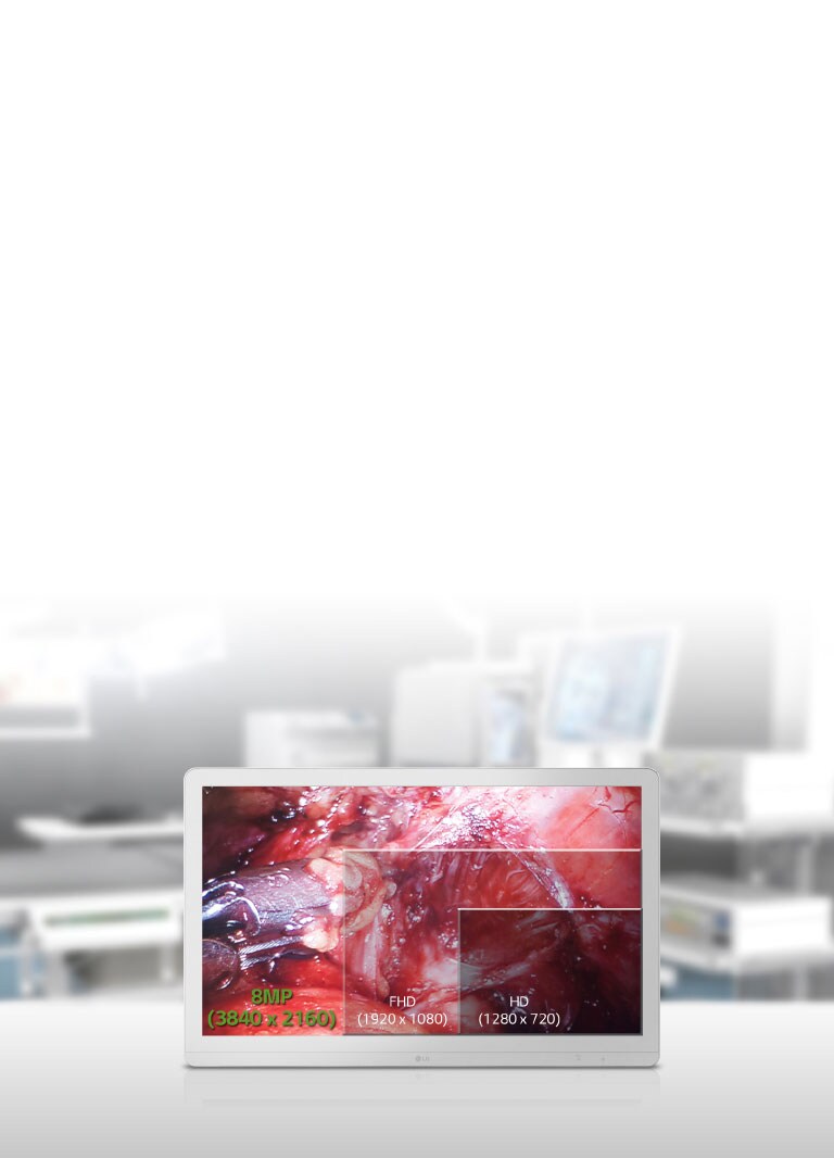 Pantalla optimizada para la sala de operaciones