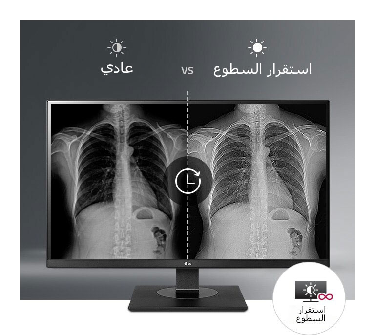 شاشة مستقرة باستمرار 1