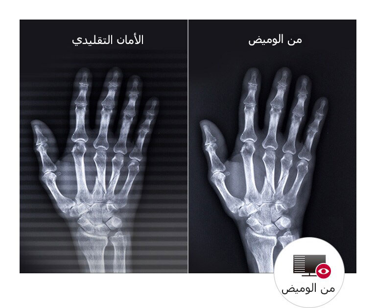 راحة عين طويلة الأمد