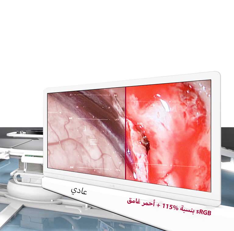 جودة الصورة المثلى1