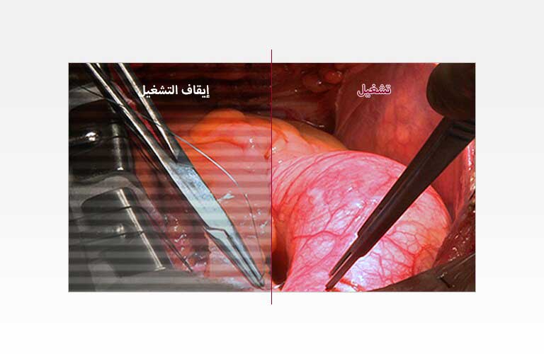 تقليل الإجهاد البصري1