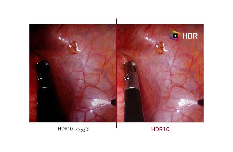 تدعم HDR101