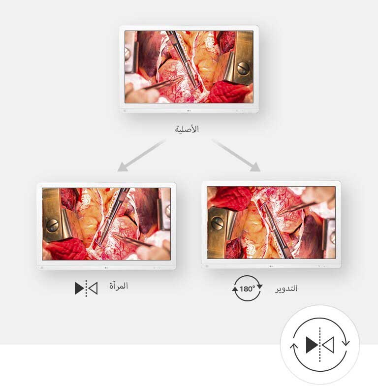 البحث عن عرض التشغيل المثالي1