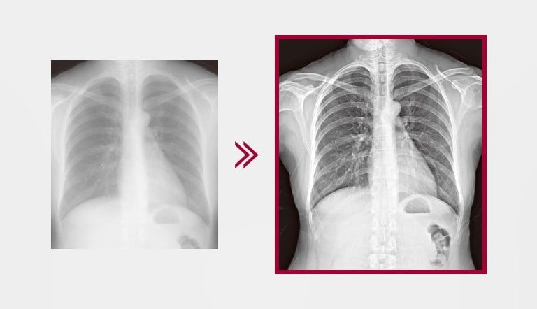 ينتج الحصول على صورة أكثر تفصيلاً من استخدام ميزة معالجة الصور المتعددة الطبقات المضمنة في AWS، مقارنة بنتائج الصور بدون استخدام ميزة معالجة الصور المتعددة الطبقات