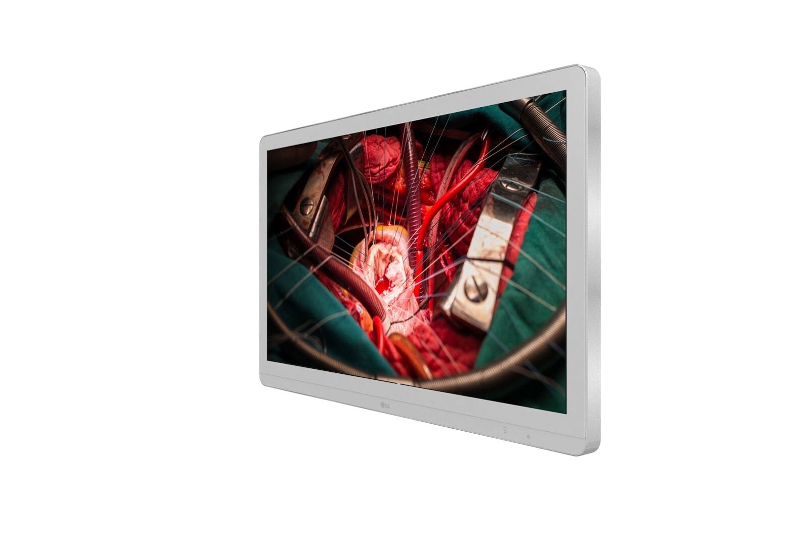 LG 27 (68.58 سم) شاشة العمليات الجراحية UHD 8 ميجابكسل, 27HJ710S-W