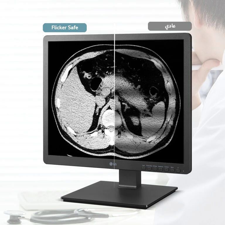 الأمان من الوميض