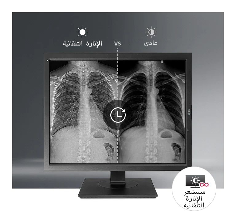 تحميل غير متزامن على الكمبيوتر الشخصي