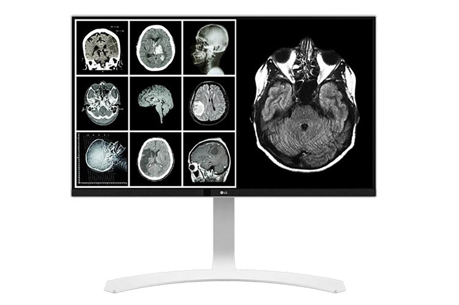 LG شاشة المراجعة السريرية بدقة 8 ميجابكسل, 27HJ712C-W