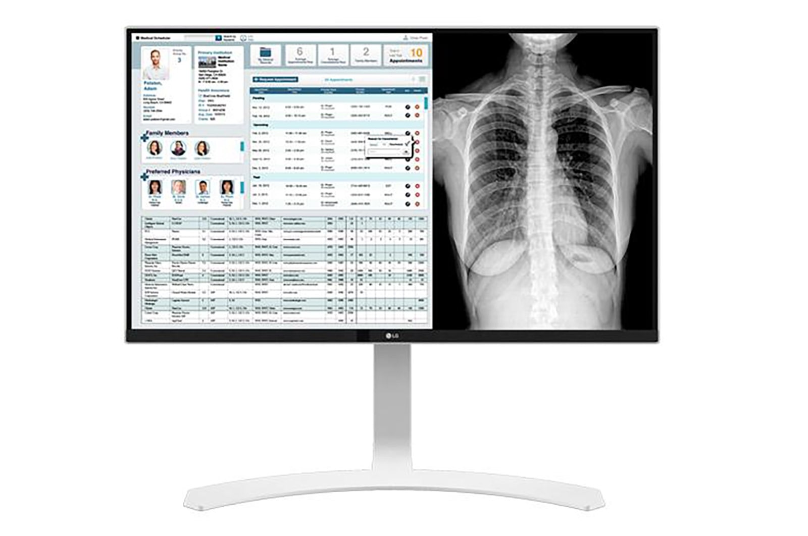 LG شاشة المراجعة السريرية بدقة 8 ميجابكسل, 27HJ712C-W