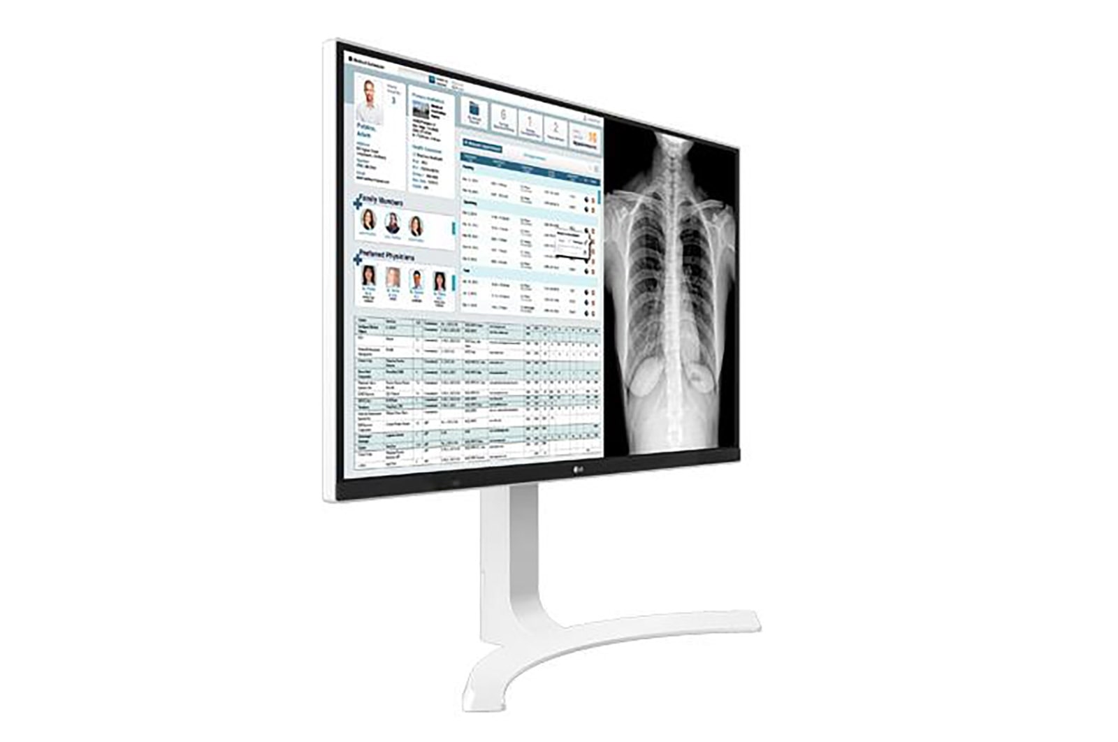 LG شاشة المراجعة السريرية بدقة 8 ميجابكسل, 27HJ712C-W