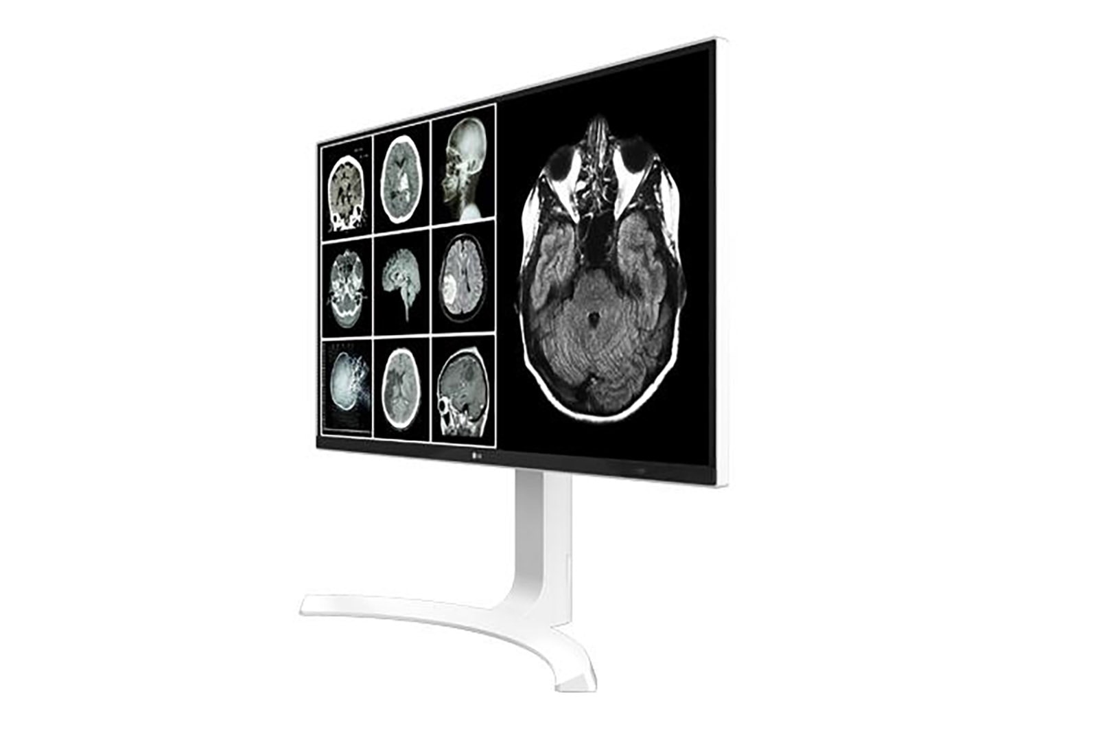 LG شاشة المراجعة السريرية بدقة 8 ميجابكسل, 27HJ712C-W