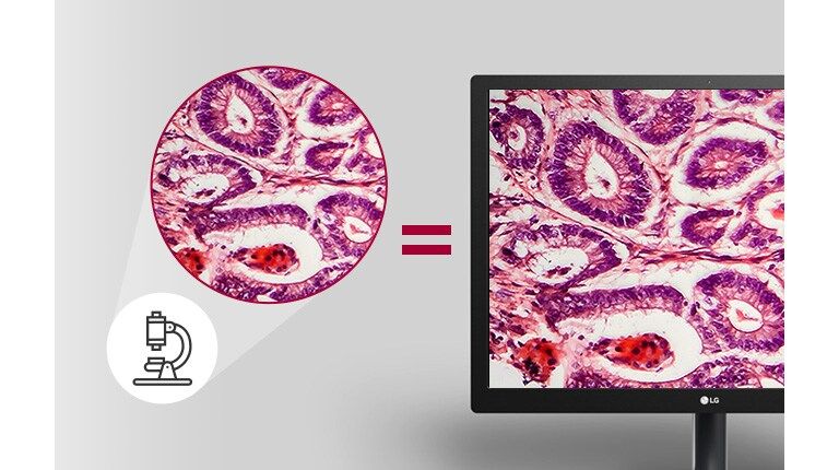 تحميل غير متزامن على الكمبيوتر الشخصي