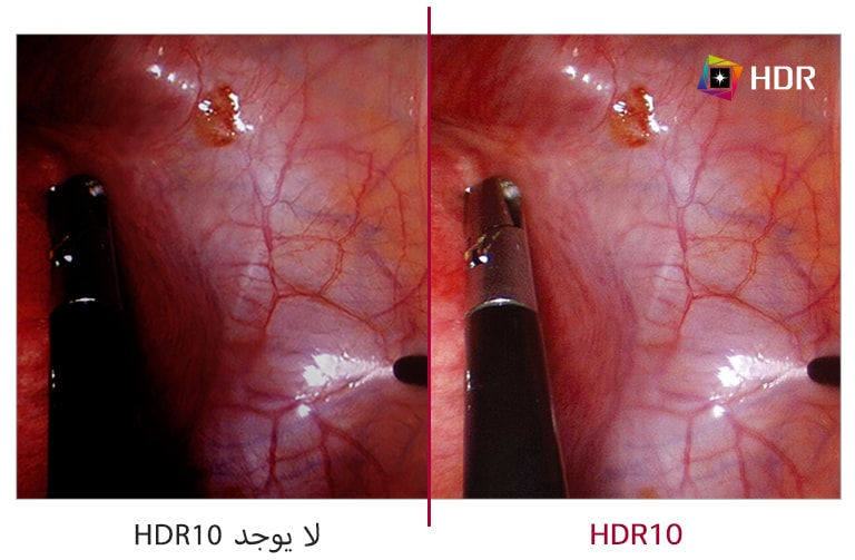 لا يوجد HDR10 مقابل HDR10