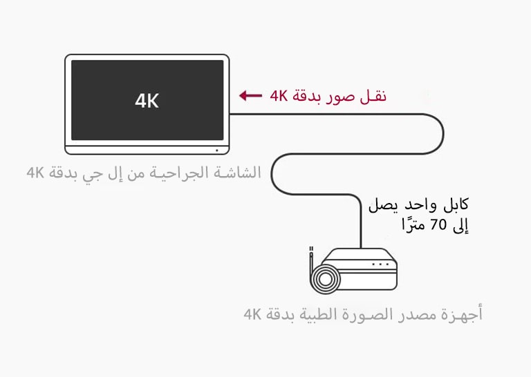 دعم 12G-SDI: تتيح الشاشة الجراحية من إل جي بدقة 4K النقل لمسافات طويلة لإشارات 4K عبر كابل محوري واحد دون تأخير لإجراء جراحة مستقرة.