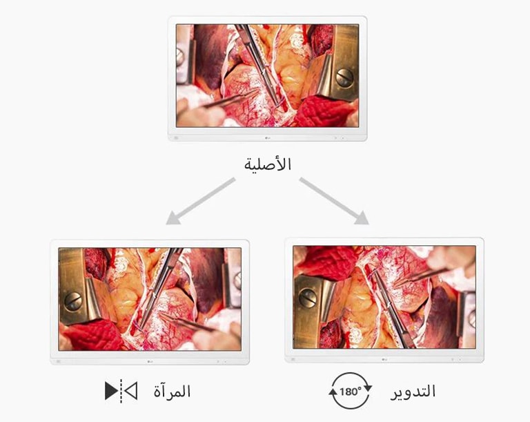 شاشة أصلية، شاشة مرآة ودوران 180 درجة