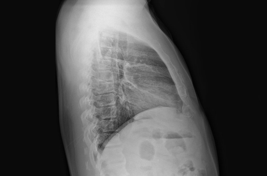 x-ray image 2. x-ray image 2.