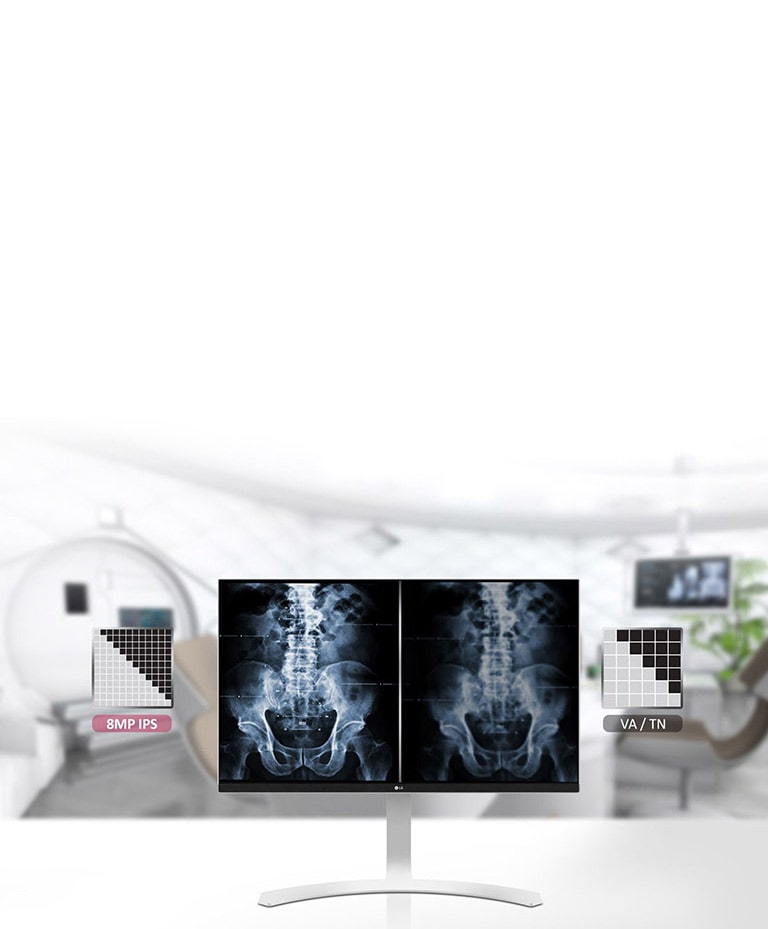 شاشة IPS بدقة 8 ميجابكسل