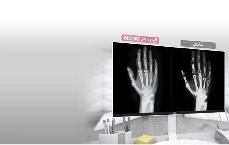 متوافق مع DICOM الجزء 14 2