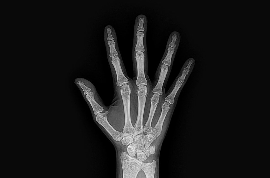 x-ray image 4.