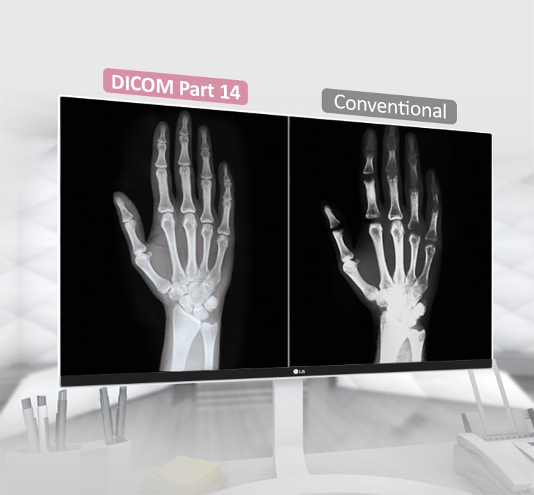 DICOM Part 14